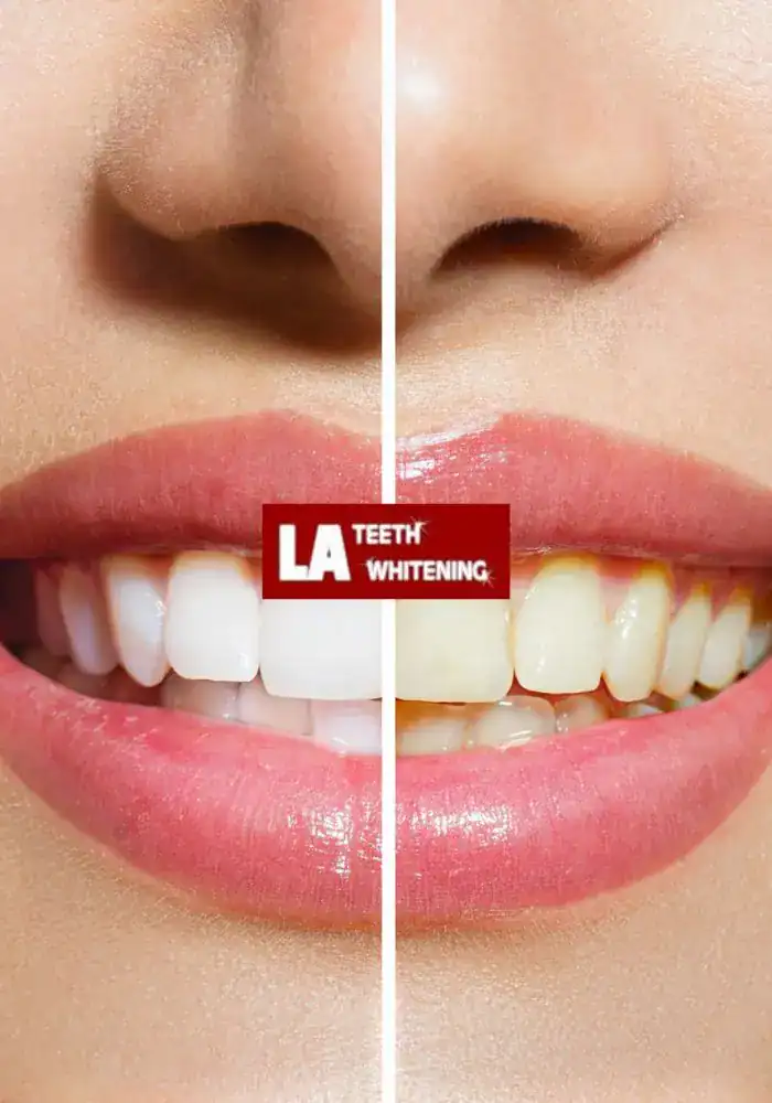 What Makes Professional Whitening Clinics Stand Out Basildon
