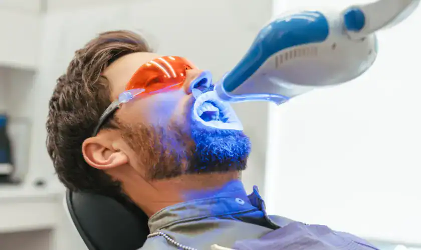 How Laser Whitening Enhances Your Smile Without Damaging Dental Work Basildon